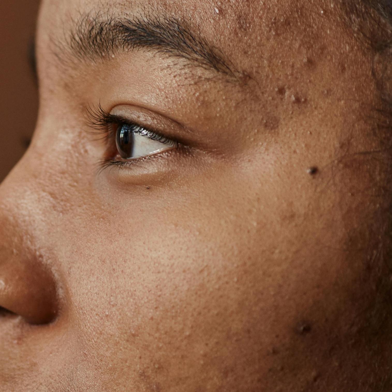 Dark spots