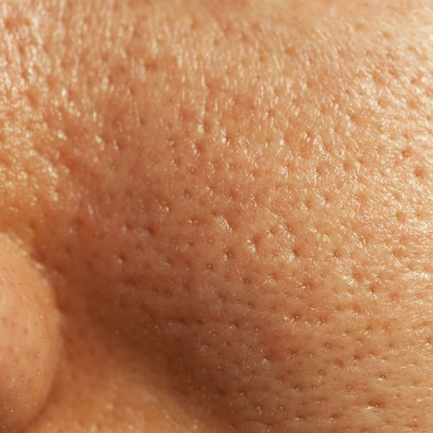 Pores